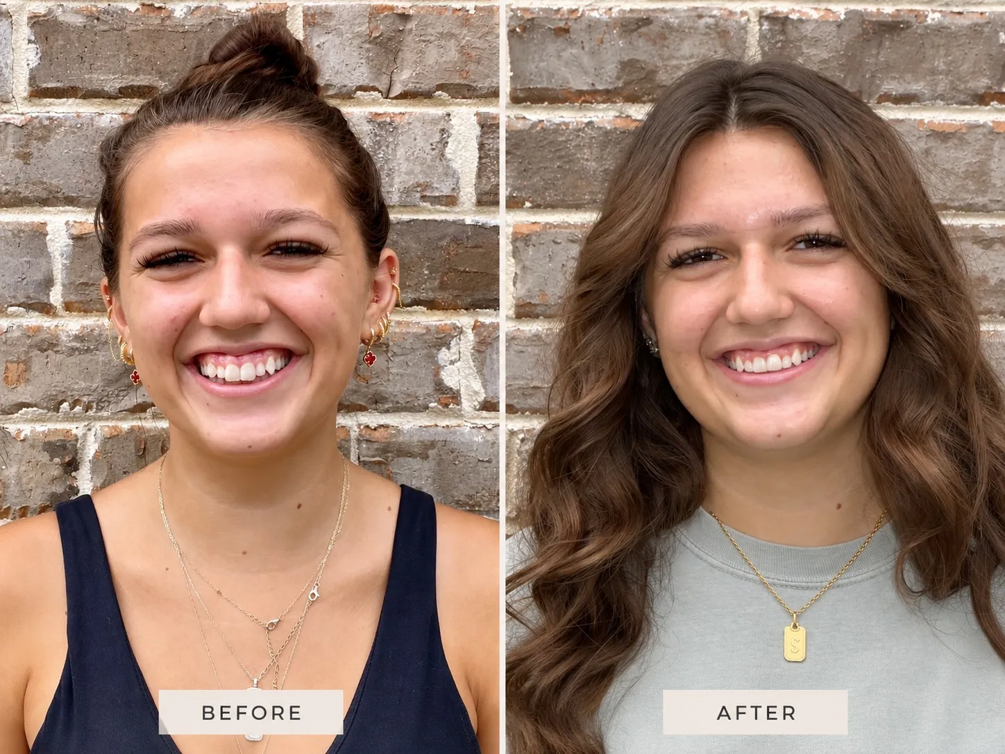 Actual Little Mountain Dentistry patient smile before treatment